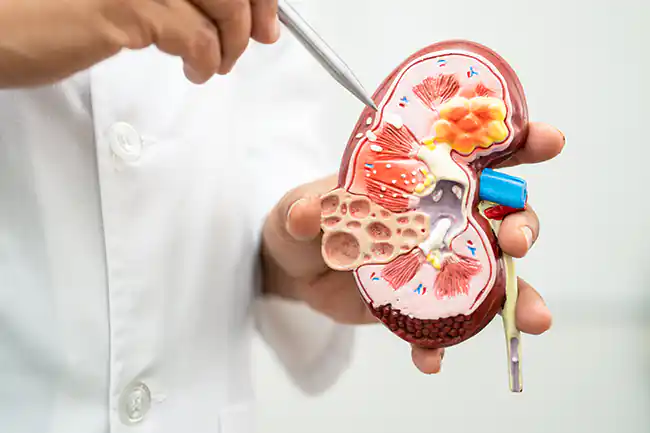 Nutricionista Doença Renal Crônica