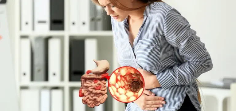 Número de Doenças Inflamatórias Intestinais Sobe 233 em 8 Anos no Brasil